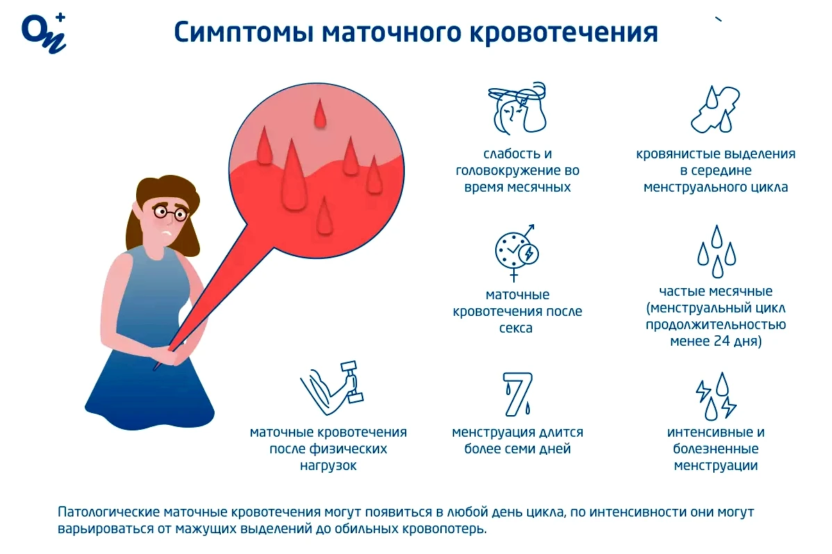 Как остановить месячные Как остановить месячные